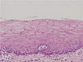 参考：子宮頚部粘膜組織ミクロ像（HE強拡大）