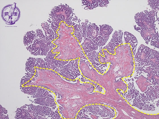 �������t���X�E�B���~�N�����iHE��g��j