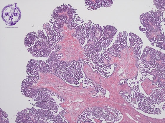 �������t���X�E�B���~�N�����iHE��g��j