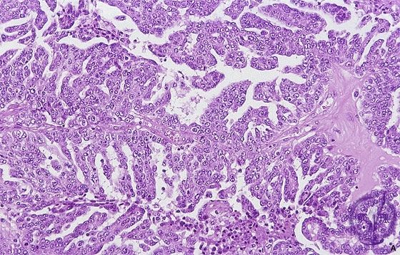 �������t���X�E�B���~�N�����iHE���g��j