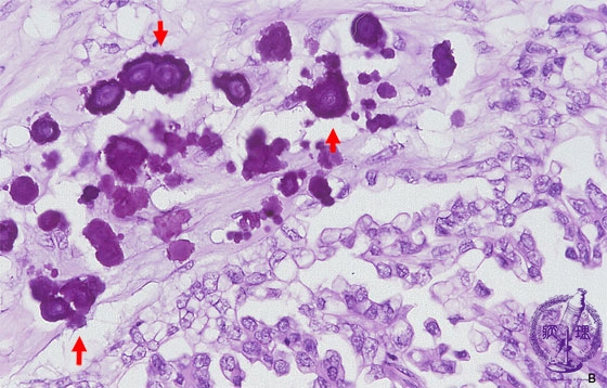 �������t���X�E�B���~�N�����iHE���g��j