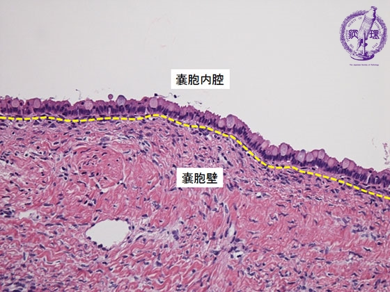 �����S�t���X�E�B��~�N����(HE���g��j