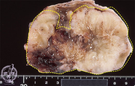 �����S�t���X�E�B���}�N����