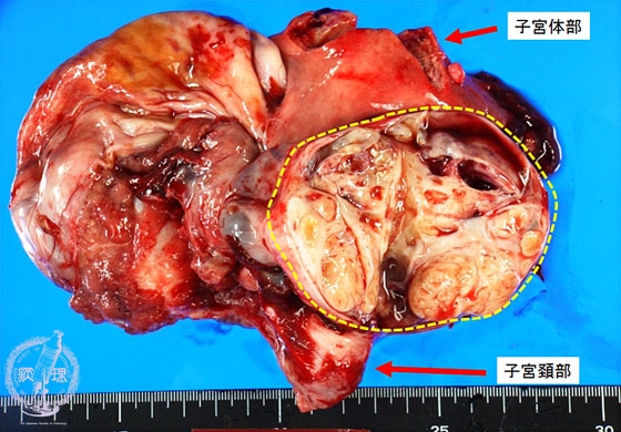 �������זE�B���}�N�����i���Œ�V�N�W�{�j