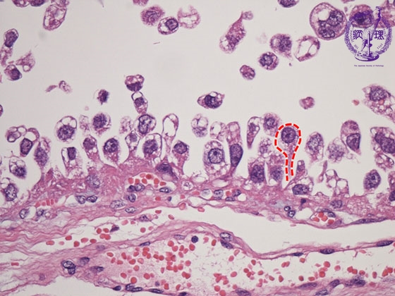 �������זE�B���~�N����(HE���g��j