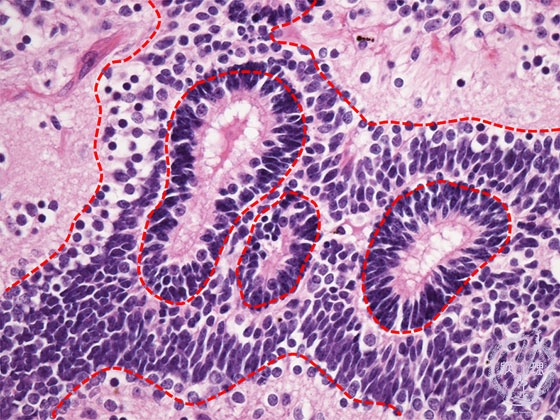 ���n��`��~�N�����iHE���g��j