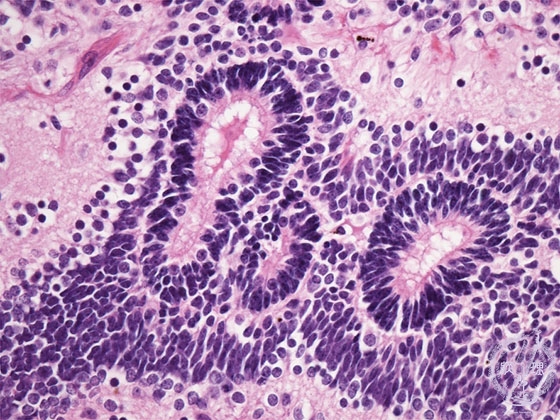 ���n��`��~�N�����iHE���g��j