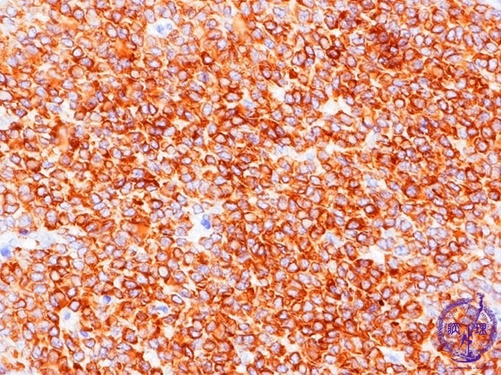 �������זE��~�N�����iinhibin�Ɖu���F���g��j