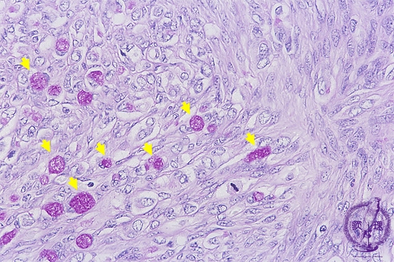 �N���P���x���O��ᇃ~�N�����i�W�A�X�^�[�[����PAS���F���g��j