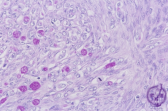 �N���P���x���O��ᇃ~�N�����i�W�A�X�^�[�[����PAS���F���g��j