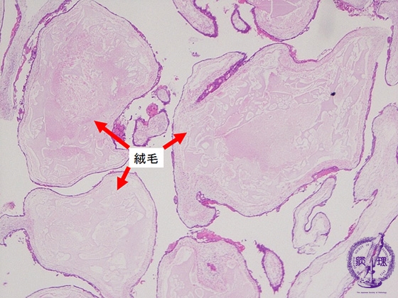 �E���فi�S�A�����j�~�N�����iHE��g��j