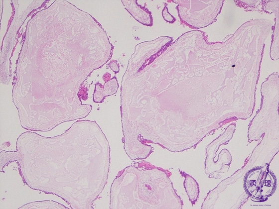 �E���فi�S�A�����j�~�N�����iHE��g��j