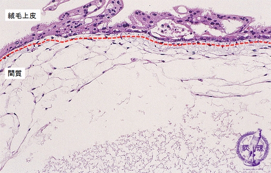 �E���فi�S�A�����j�~�N�����iHE���g��j