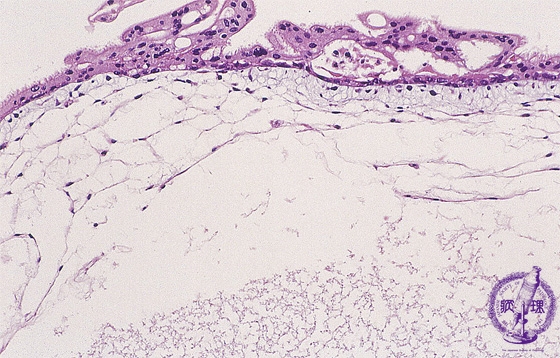 �E���فi�S�A�����j�~�N�����iHE���g��j