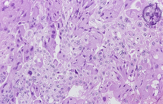 �O�ъ��~�N�����iHE��g��j