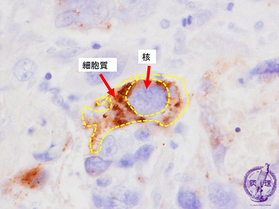 �O�ъ��~�N�����i�q�g�O�ѐ��S�i�h�g���s���ih-CG�j�Ɖu���F���g��j