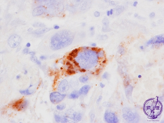 �O�ъ��~�N�����i�q�g�O�ѐ��S�i�h�g���s���ih-CG�j�Ɖu���F���g��j