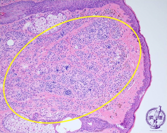 ����זE����i�^����E���E�E�����j�~�N�����iHE��g��j