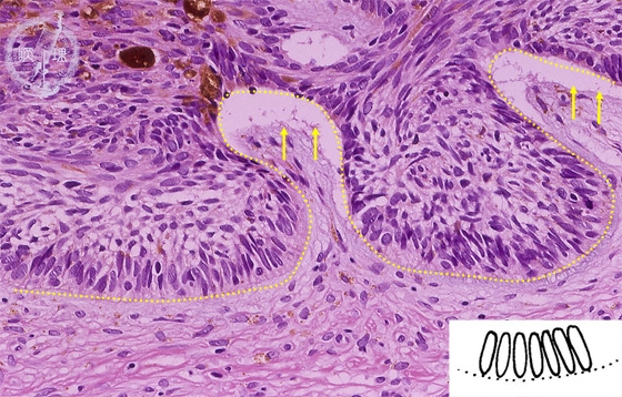 ���זE���~�N�����iHE���g��j