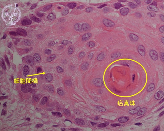 �G�������~�N�����iHE���g��j