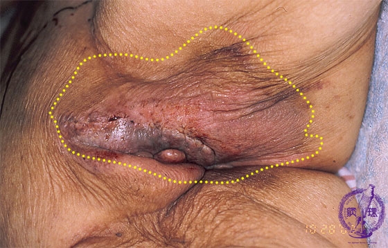 ���[�OPaget�a�}�N����