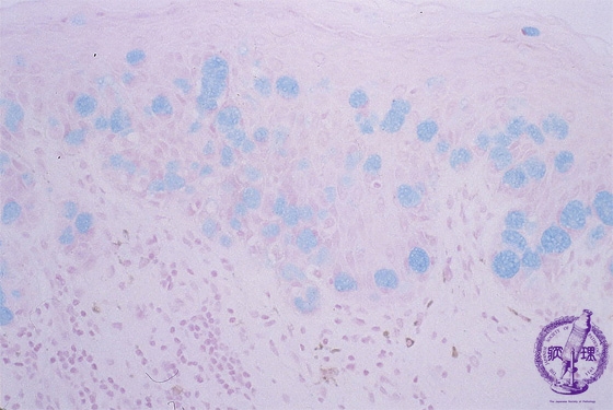 ���[�OPaget�a�~�N�����i�A���V�A���ialcian blue�j���F���g��j