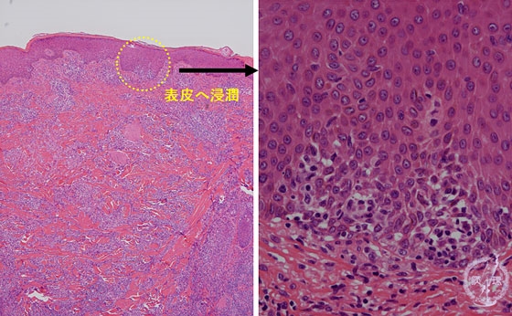 �畆���������p��i�ۏ󑧓��ǁj�~�N�����iHE����g��A�E���g��j