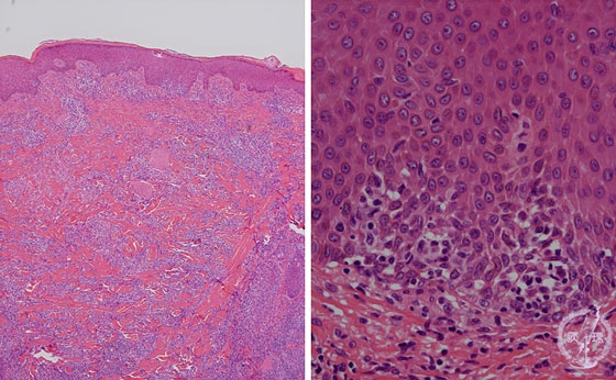 �畆���������p��i�ۏ󑧓��ǁj�~�N�����iHE����g��A�E���g��j