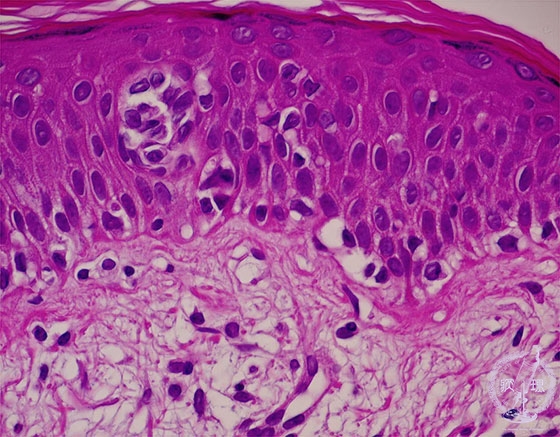 �畆���������p��i�ۏ󑧓��ǁj�~�N�����iHE���g��j