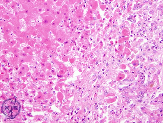 Pathology Core Pictures