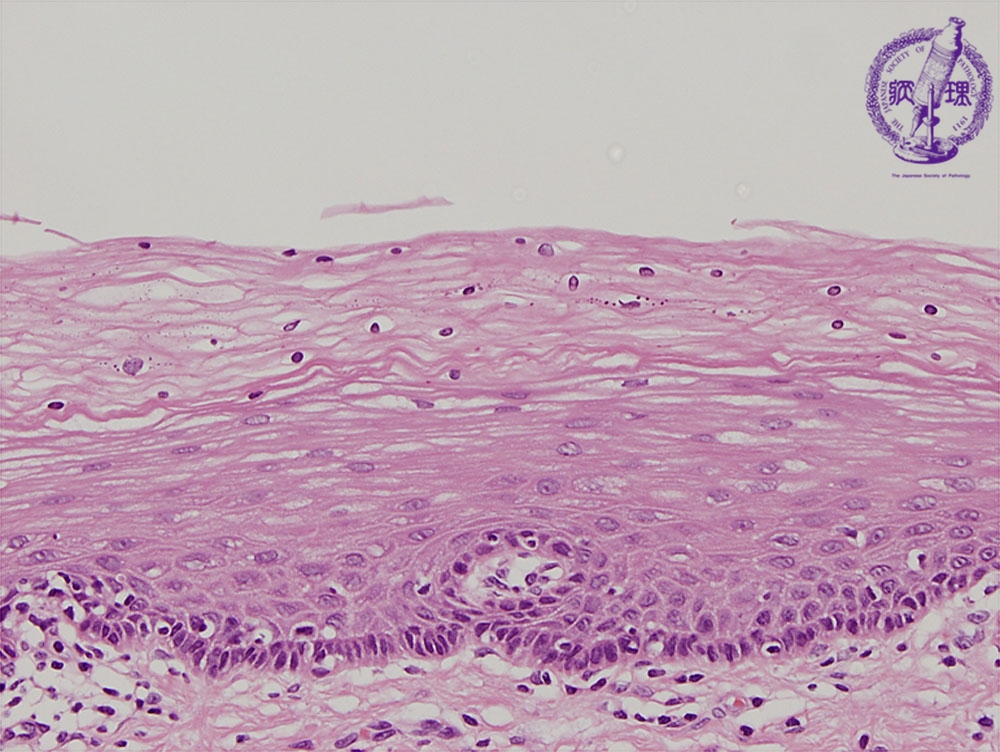 15.Female genital organs (4) Control: Normal cervical mucosal 